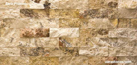 Zara Picasso Veneers
